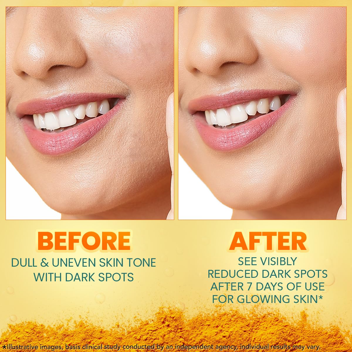 Himalaya Dark Spot Clearing Turmeric Face Serum, 30 mL | with 10% Glycolic Acid, 2% Niacinamide & Organically sourced Turmeric | Visibly Reduces Dark Spots from Day 7 | Clinically Tested | Non Staining