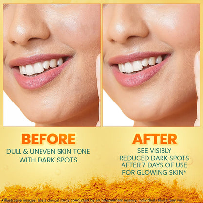 Himalaya Dark Spot Clearing Turmeric Face Serum, 30 mL | with 10% Glycolic Acid, 2% Niacinamide & Organically sourced Turmeric | Visibly Reduces Dark Spots from Day 7 | Clinically Tested | Non Staining
