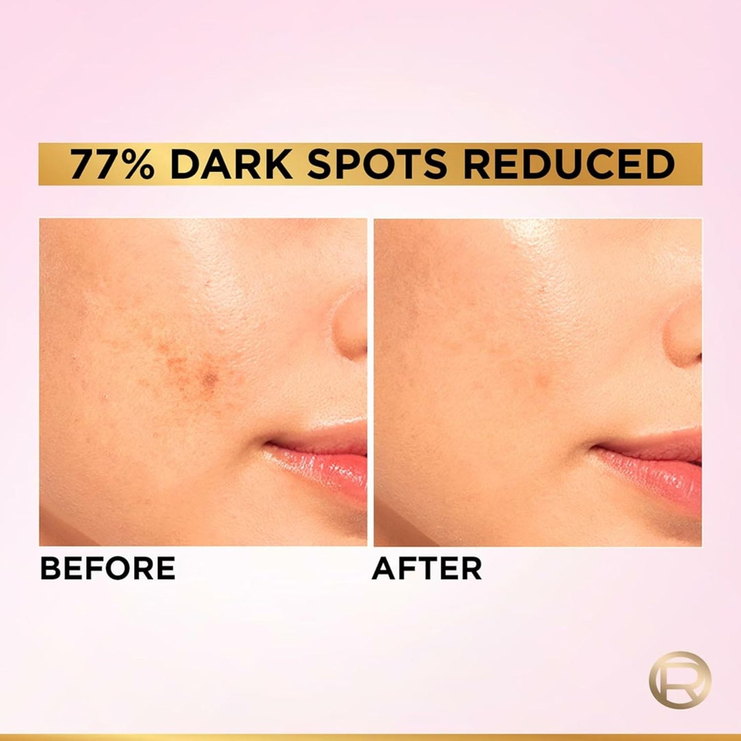 L'Oreal Paris Glycolic Bright 8% [Melasyl + Niacinamide] Face Serum for Brightening Dark Spots 30ml