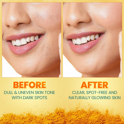 Himalaya Dark Spot Clearing Turmeric Face Serum, 30 mL | with 10% Glycolic Acid, 2% Niacinamide & Organically sourced Turmeric | Visibly Reduces Dark Spots from Day 7 | Clinically Tested | Non Staining