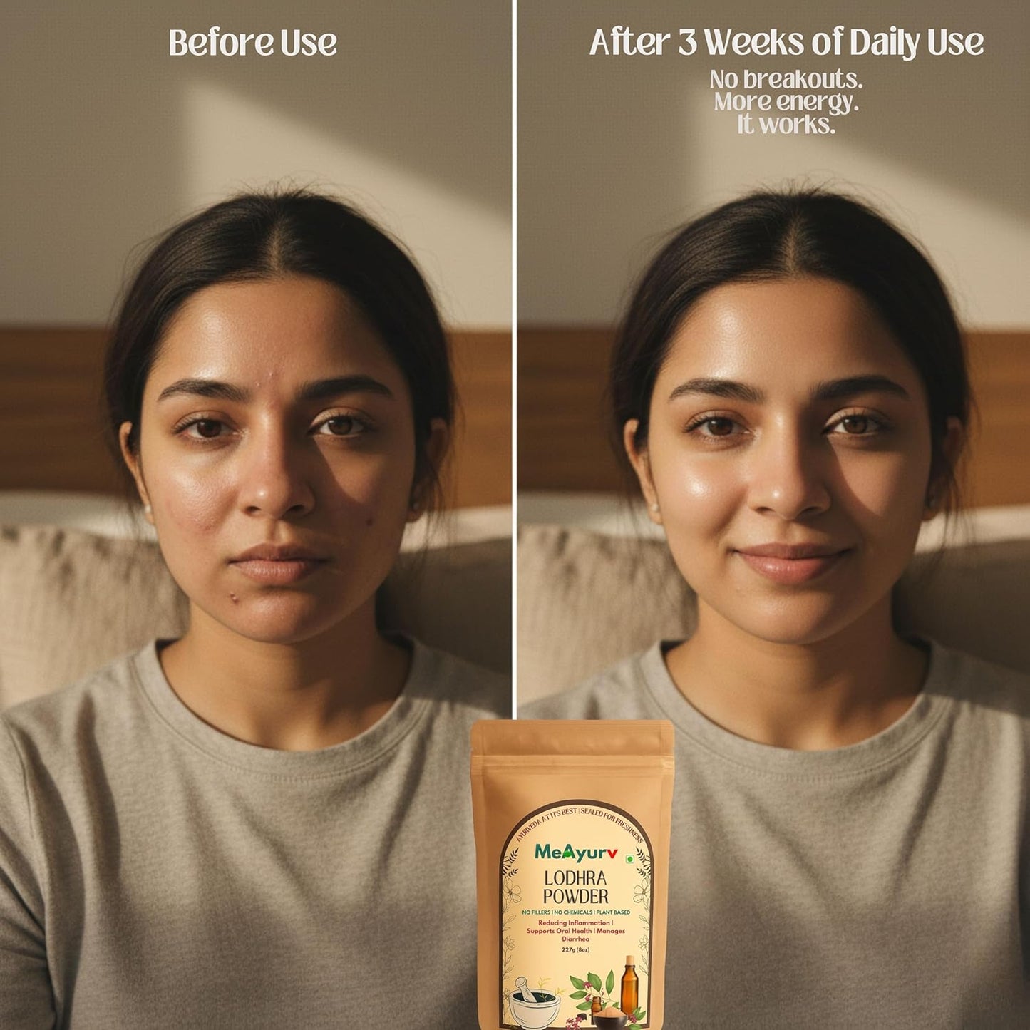 MeAyurv Organic Lodhra Powder 55g – Pure Symplocos Bark | Ayurvedic Herbal Supplement for Skin Health & Hormonal Balance | Natural, Vegan, Chemical Free