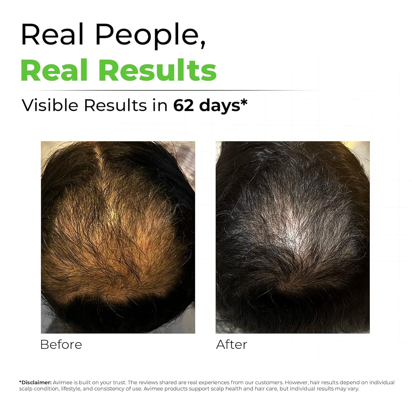 Avimee Herbal Keshpallav Hair Oil for Hair Growth | For Both Men & Women | Helps to reduce Hair Fall | With Rosemary, Castor, Amla, Coconut and Bhringraj Oil | Mineral Oil Free | 100 ml
