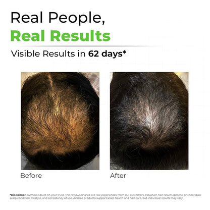 Avimee Herbal Keshpallav Hair Oil for Hair Growth | For Both Men & Women | Helps to reduce Hair Fall | With Rosemary, Castor, Amla, Coconut and Bhringraj Oil | Mineral Oil Free | 100 ml